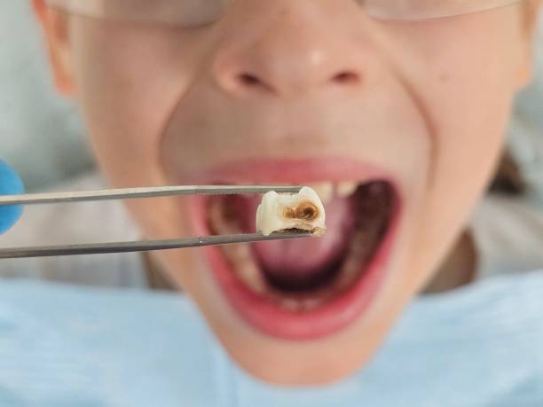Best Emergency Gum Treatment in Alamo, GA